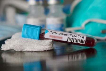 OMRON enables medical diagnostics industry to produce effective COVID-19 testing kits